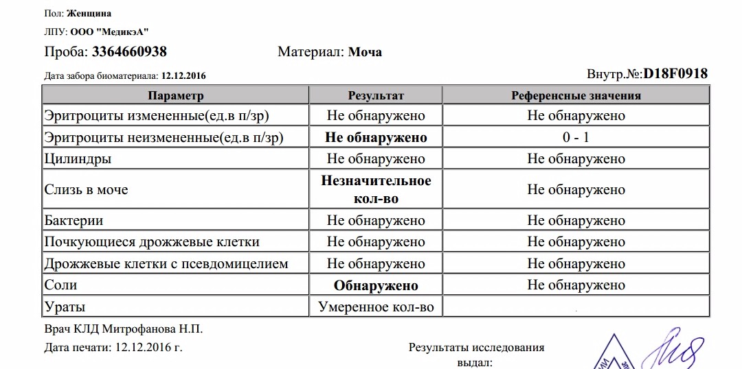 Белок и соли в моче