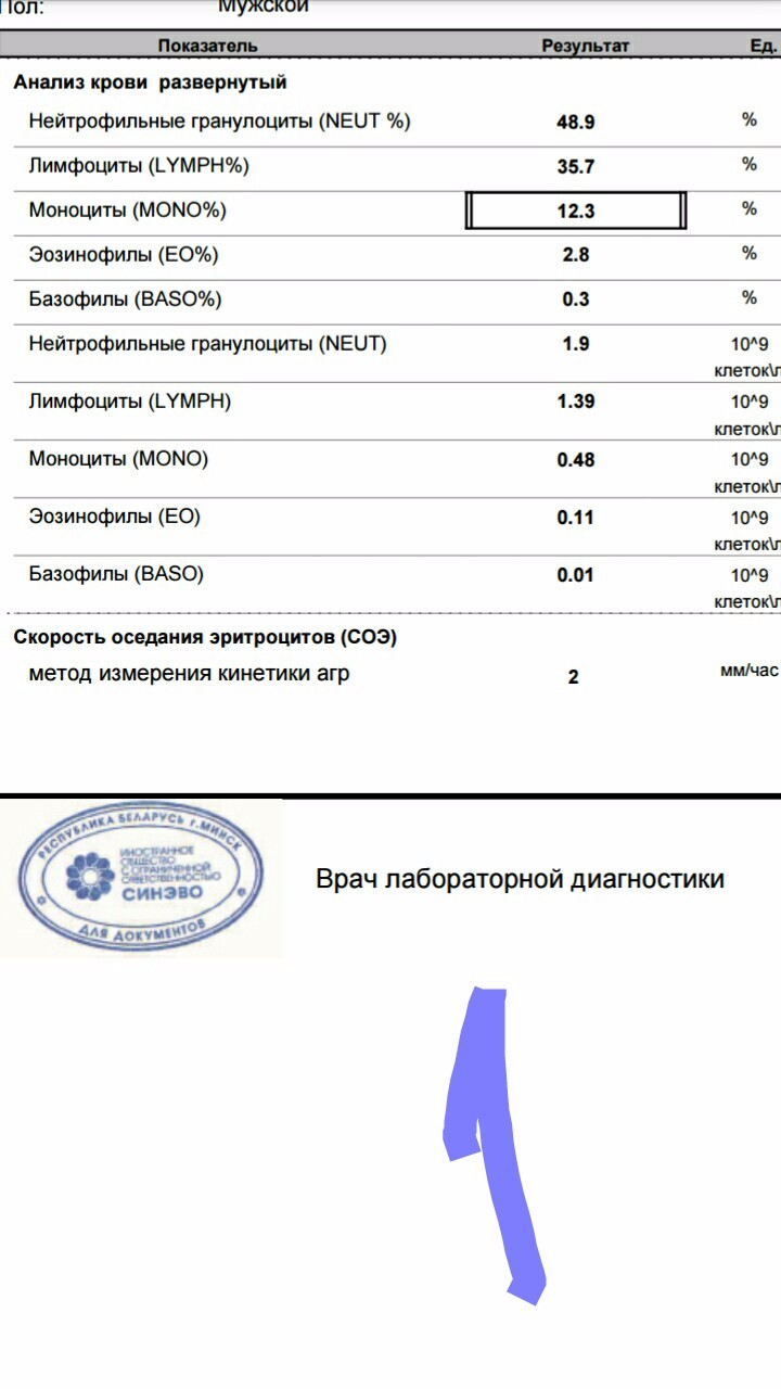 Анализ лимфоциты повышены. Анализ крови норма в лимфоциты в крови. Снижены лимфоциты в ОАК. Анализ крови расшифровка лимфоциты повышены. Расшифровка анализа т-лимфоциты.