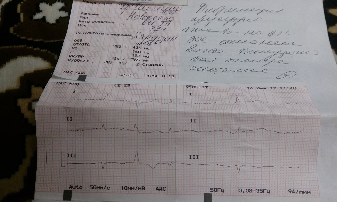 Расшифровка кардиограммы онлайн по фото бесплатно