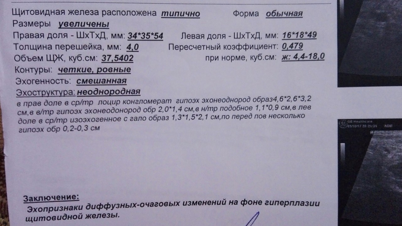 Усиление сосудистого рисунка щитовидной железы что это значит