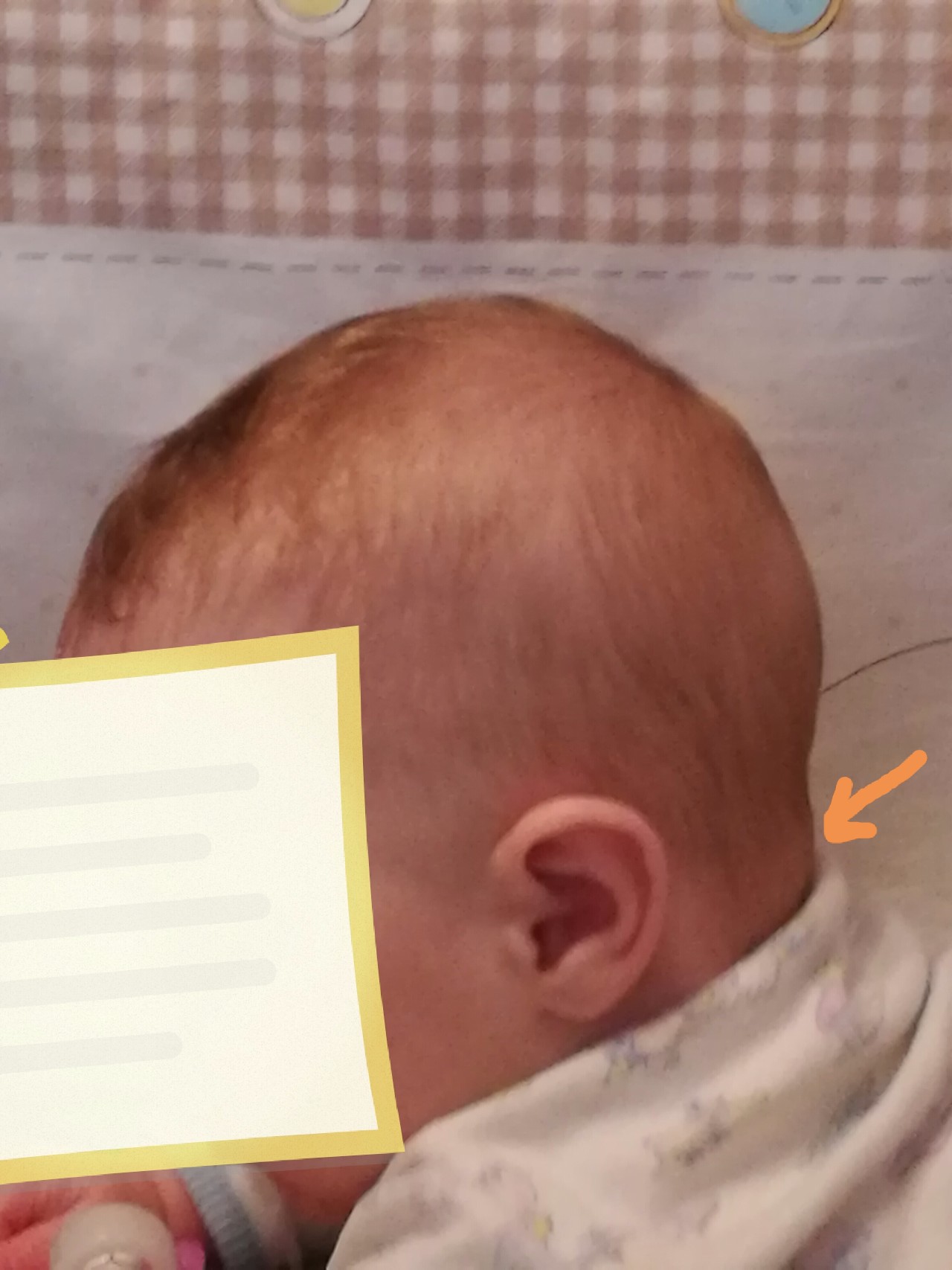 Затылок норма. Форма головы у грудничка. Форма головы у ребенка в 3 месяца. Голова месячного ребенка.