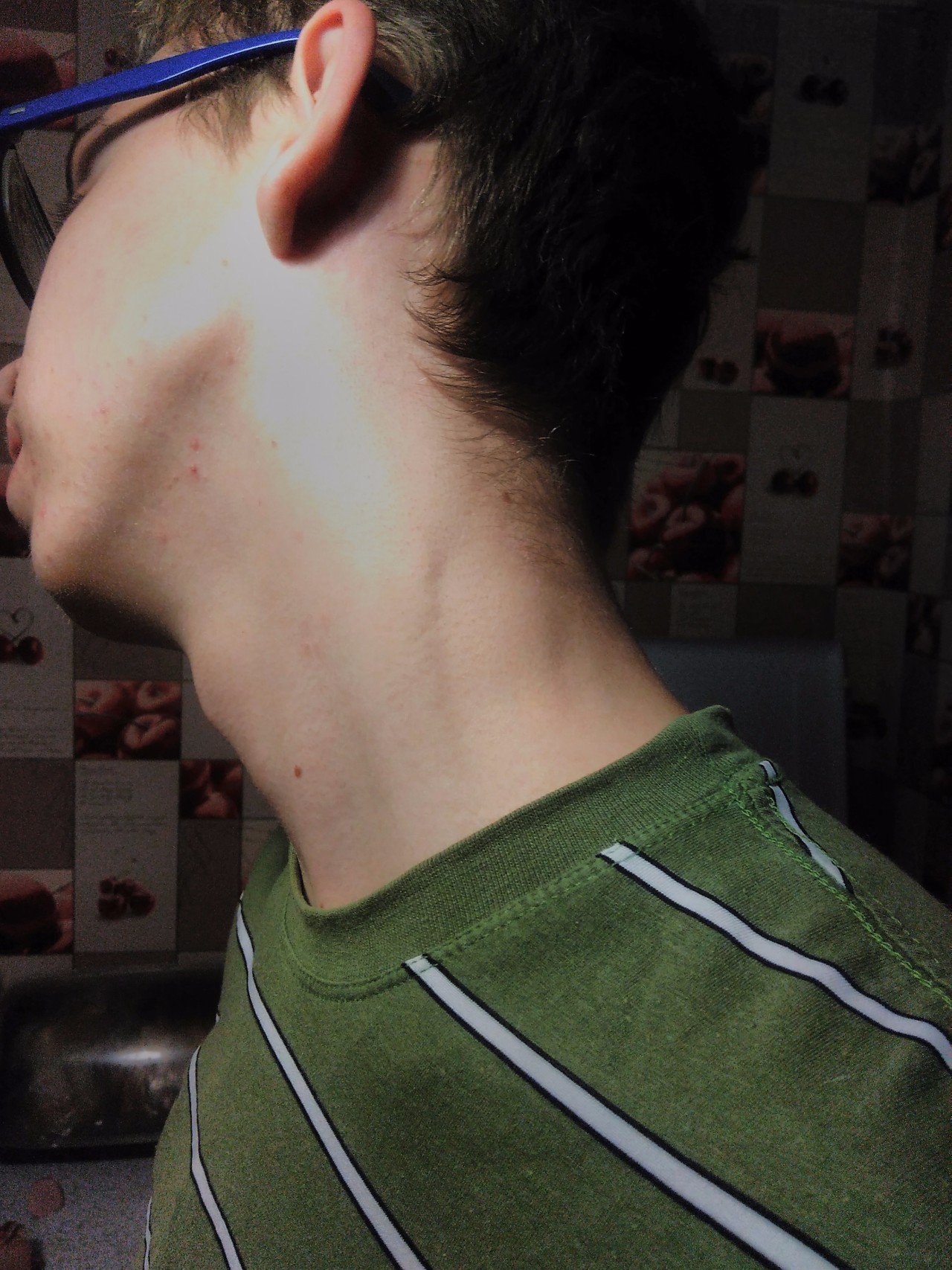 Как выглядит воспаление лимфоузлов на шее фото