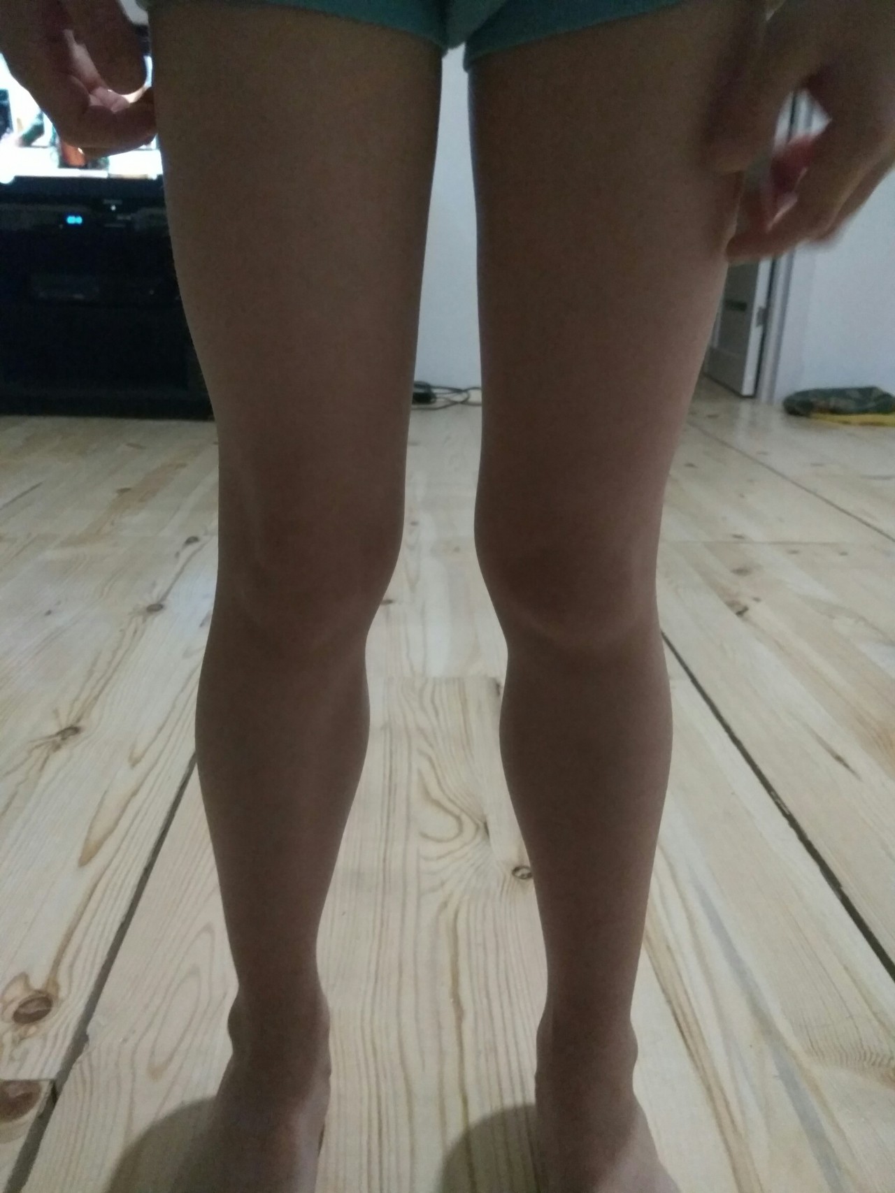 Ноги с выпирающими коленками