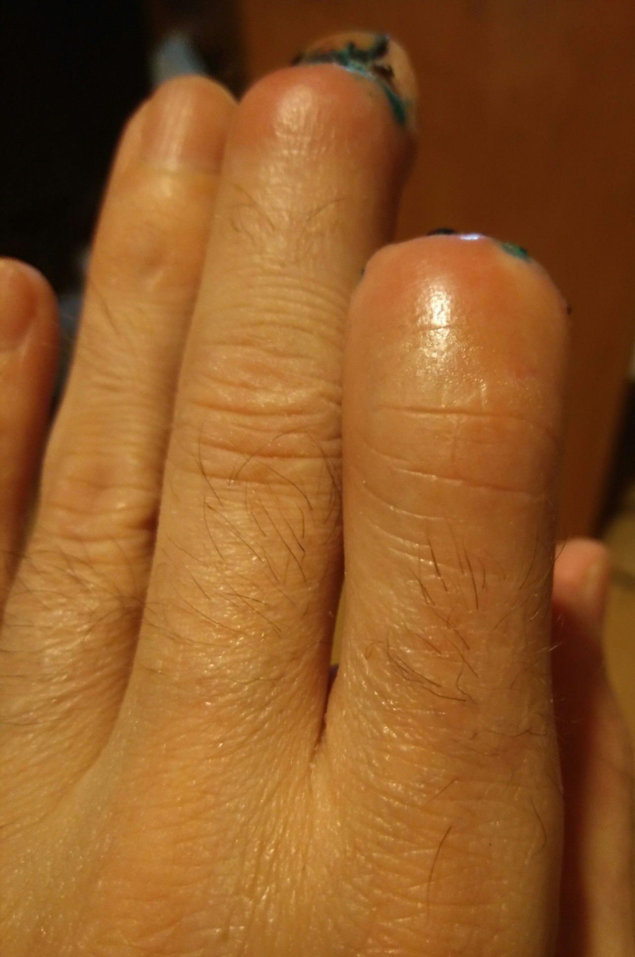 Фаланга пальца на ноге фото