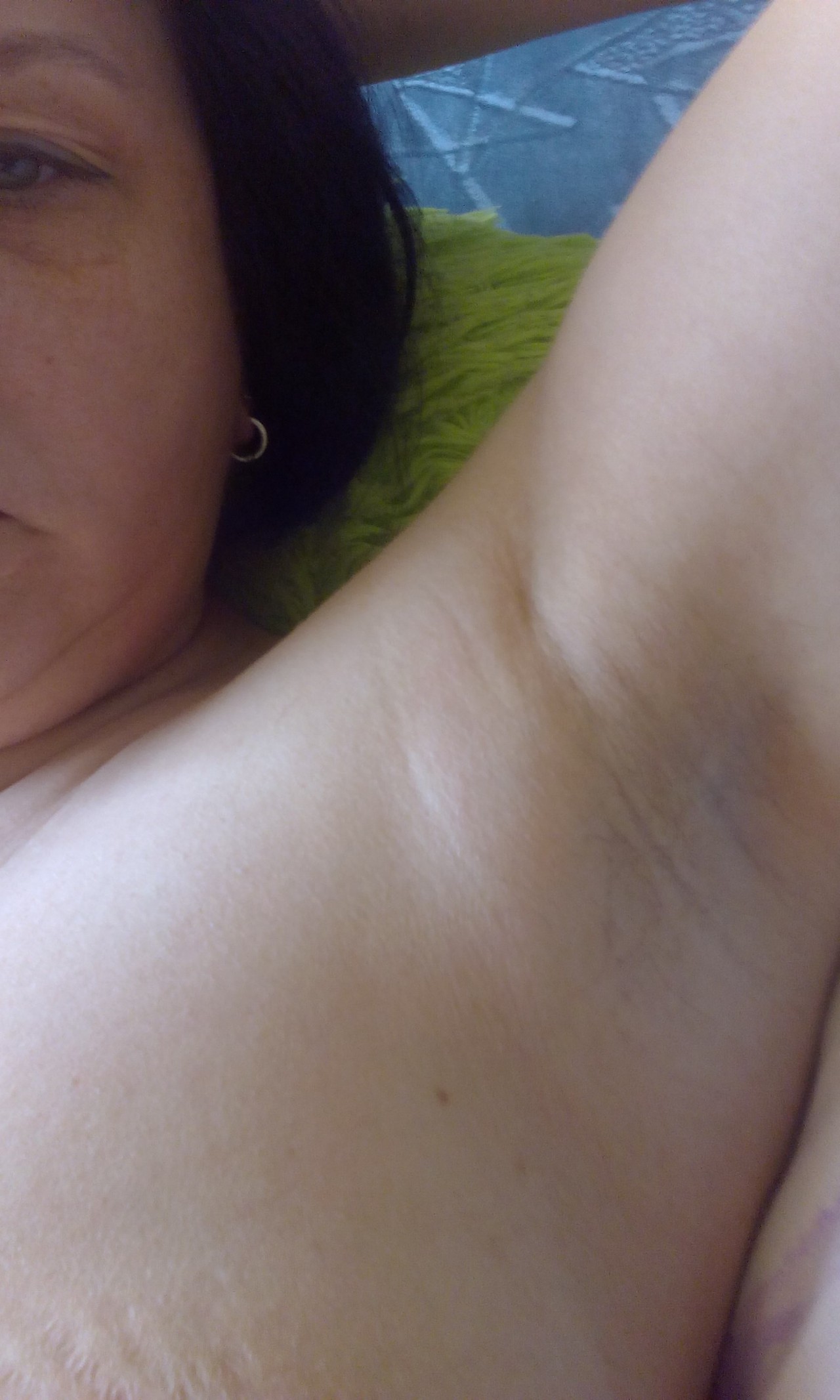 воспаление лимфоузлов на груди у женщин фото 40