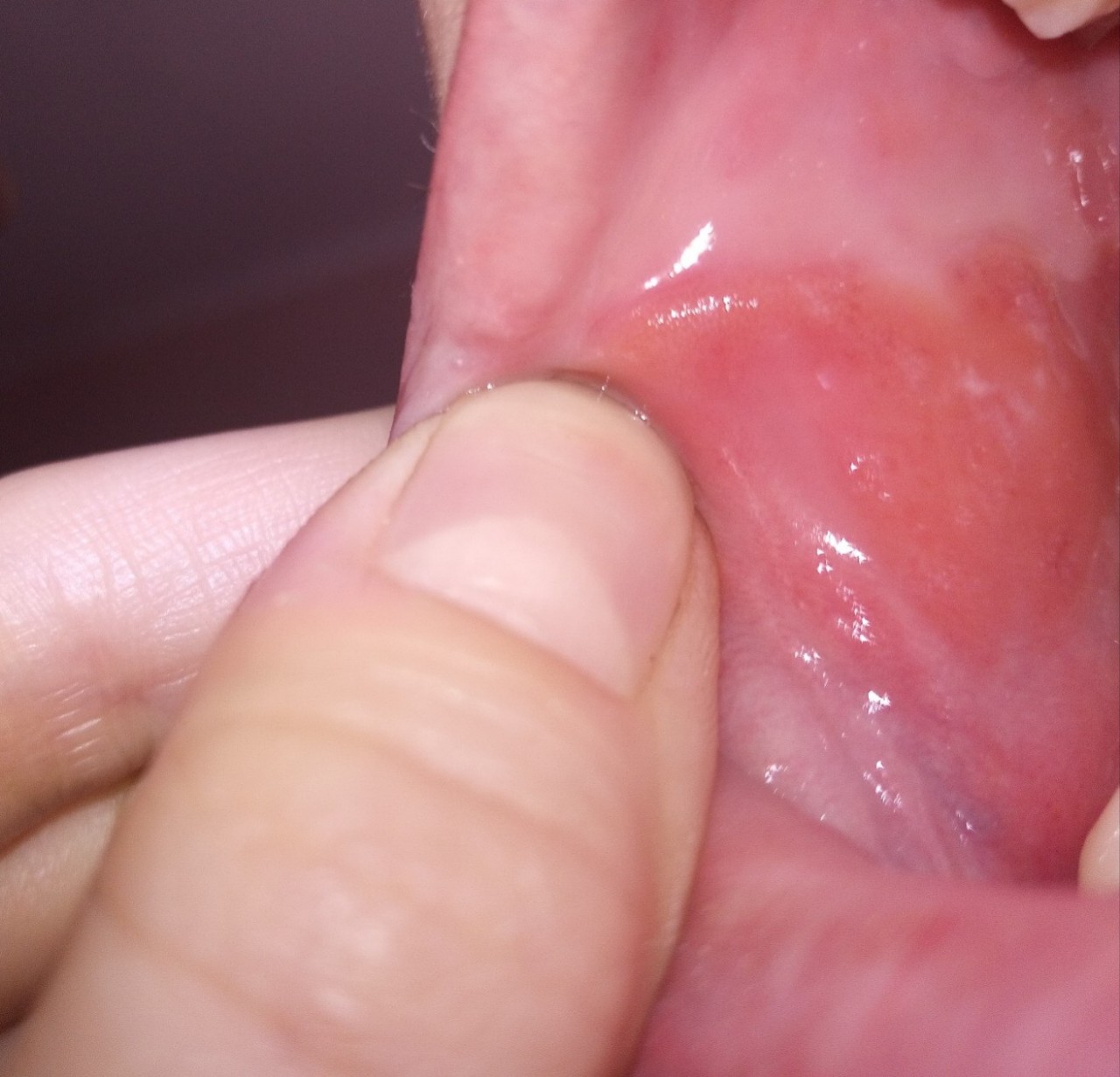 сперма на слизистой рта фото 62