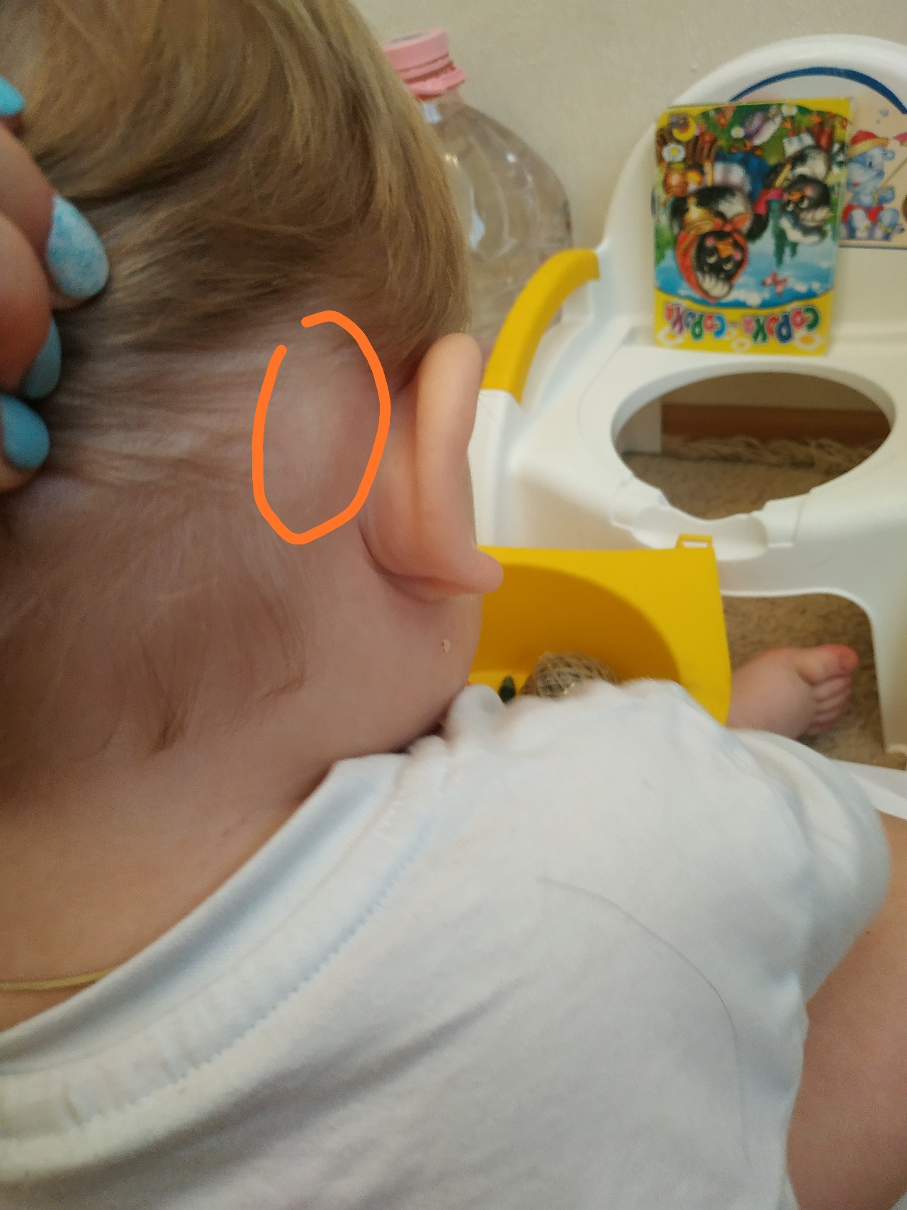 Шишечки за ушами у ребенка