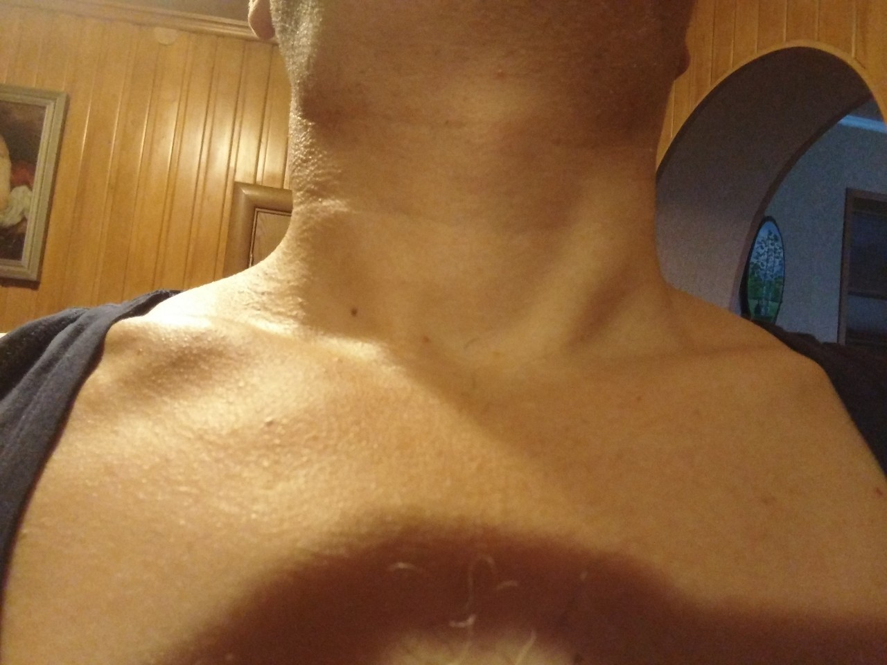 уплотнение на груди слева у мужчин фото 44