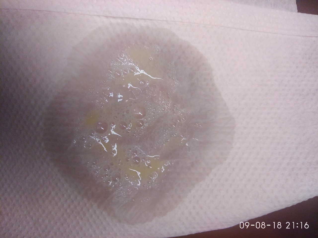 твердые желтые комочки в сперме фото 43