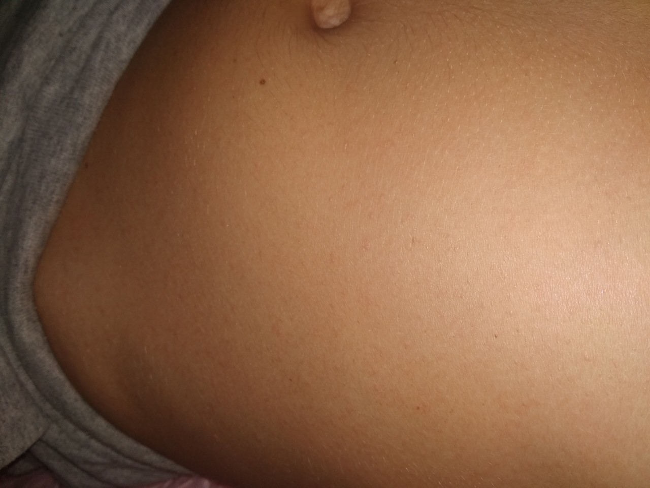 чешется грудь и живот во время беременности фото 80