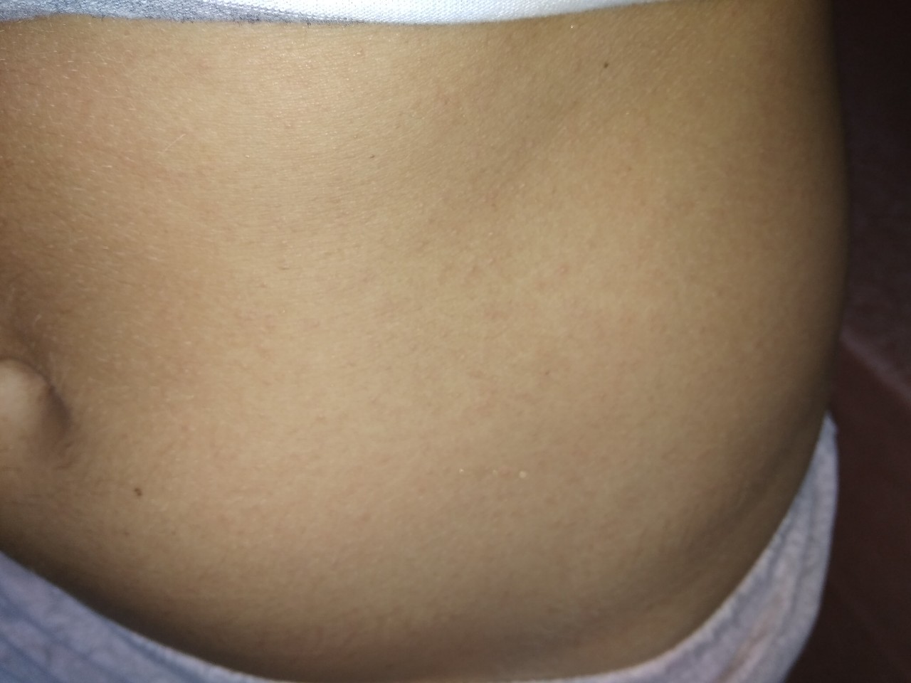 красная сыпь на груди во время беременности фото 114