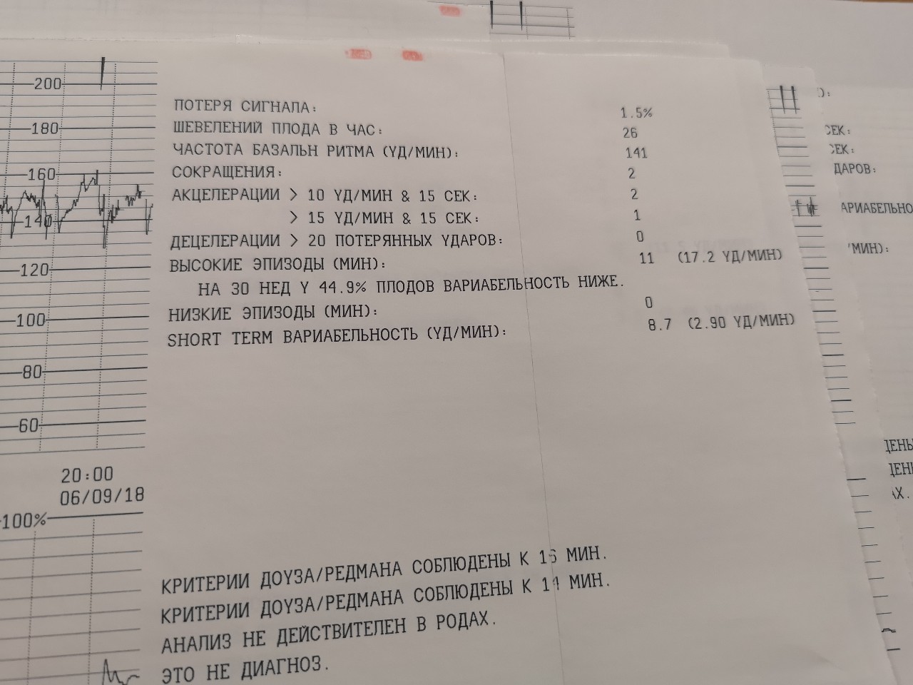 Ктг плода при беременности. Показатели КТГ норма. Показатели КТГ плода норма. Показатели КТГ плода расшифровка. КТГ расшифровка показателей норма.