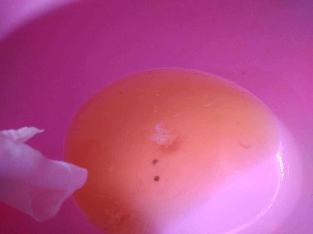 сгустки крови в моче и сперме у мужчин фото 19