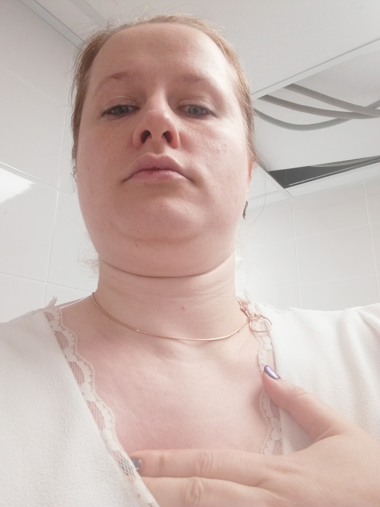 воспаление лимфоузлов на груди у женщин фото 56