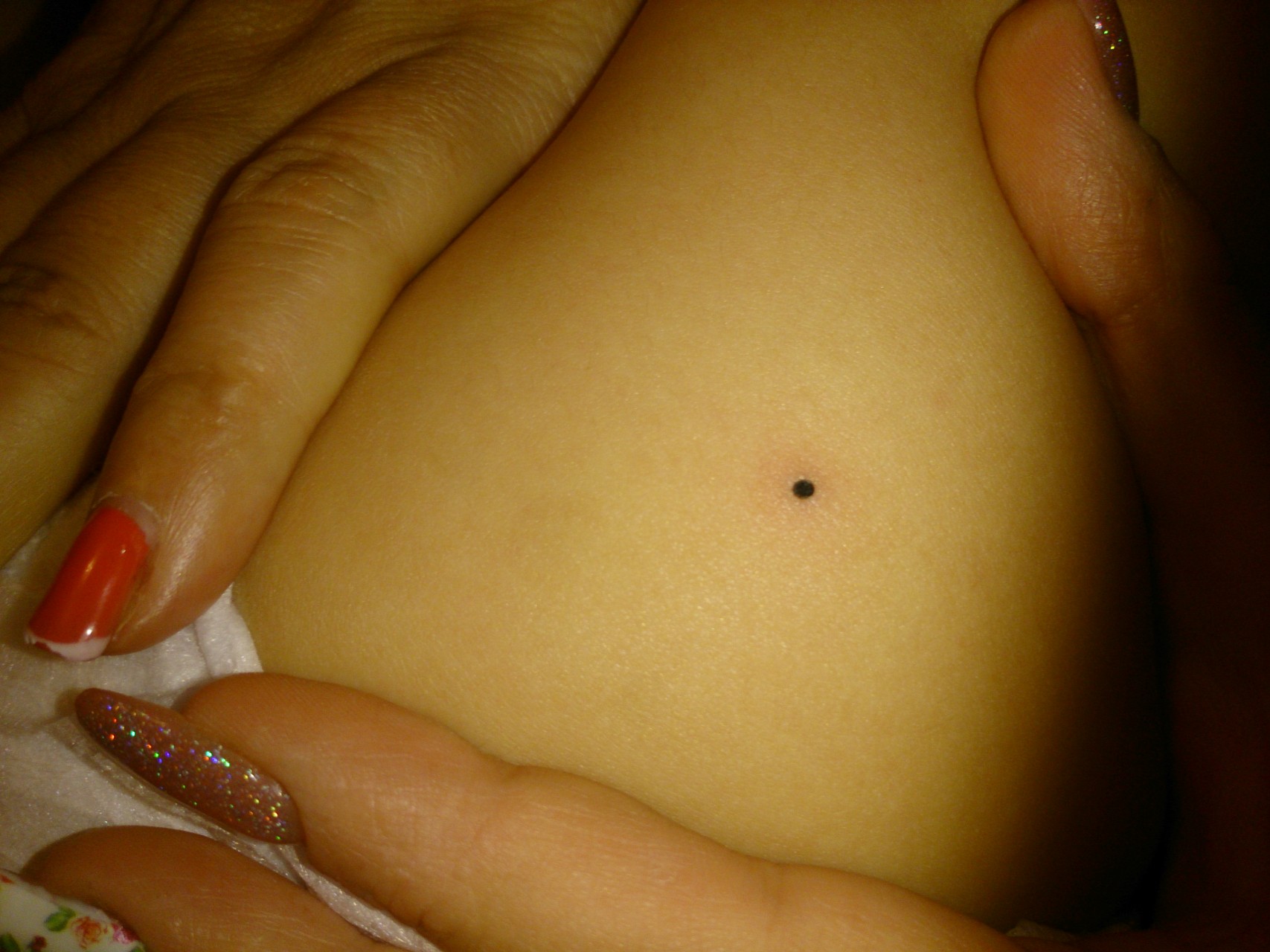 Чёрные точки на теле новорожденного