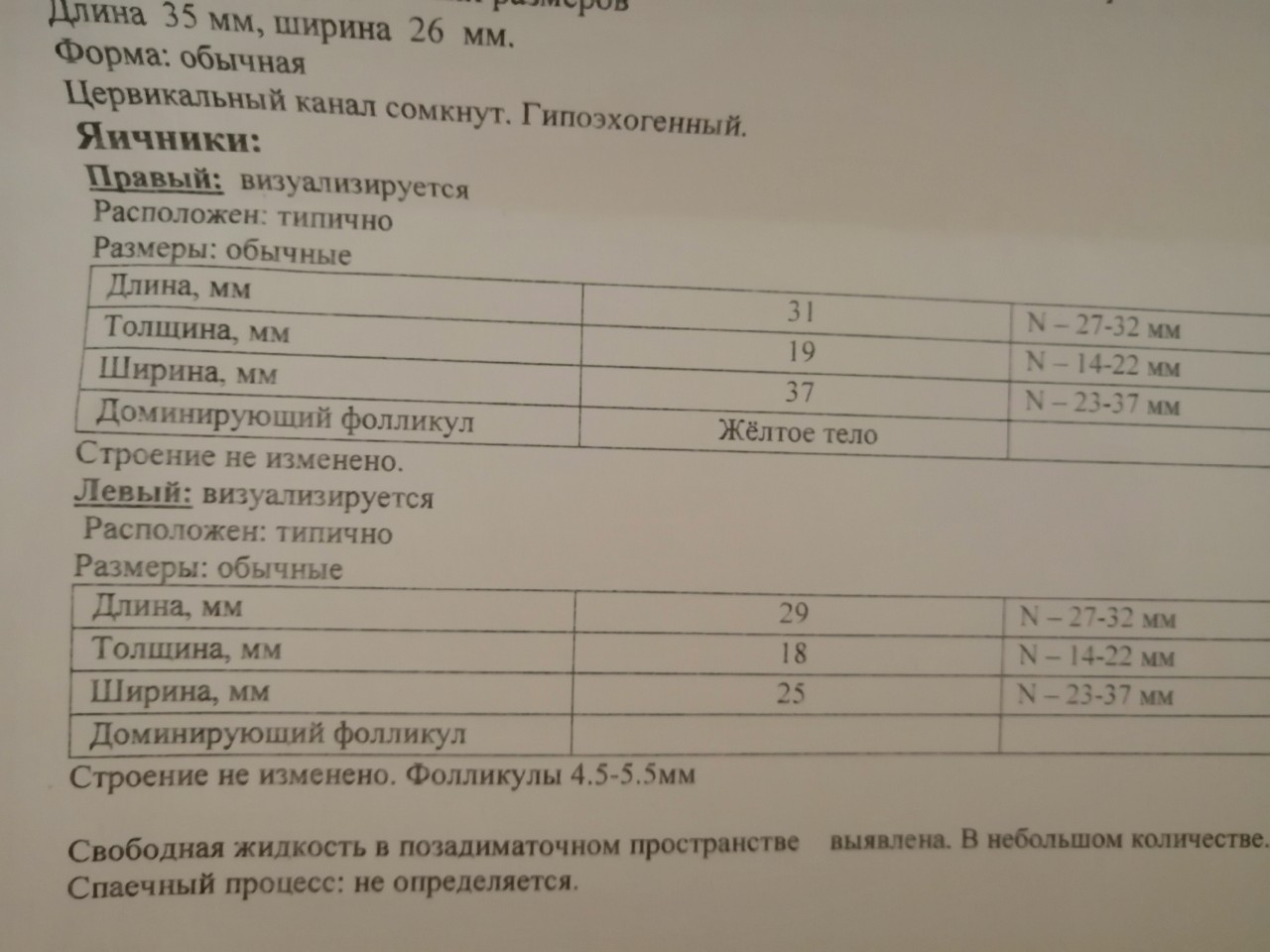 Эхо признаки аденомиоза на узи. Аденомиоз код мкб 10. Косвенные Эхо-признаки LYH.