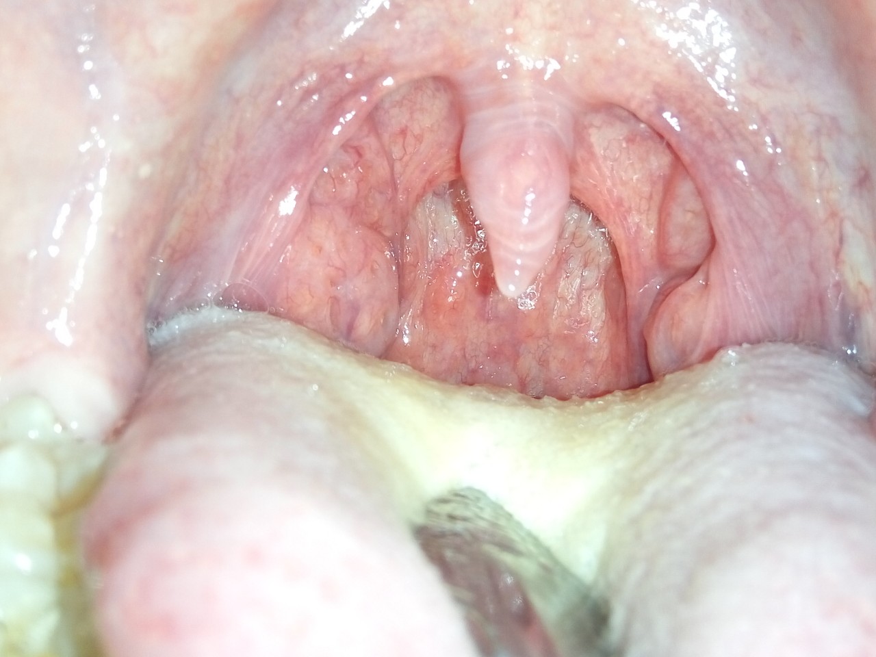 можно ли вылечить горло спермой фото 39