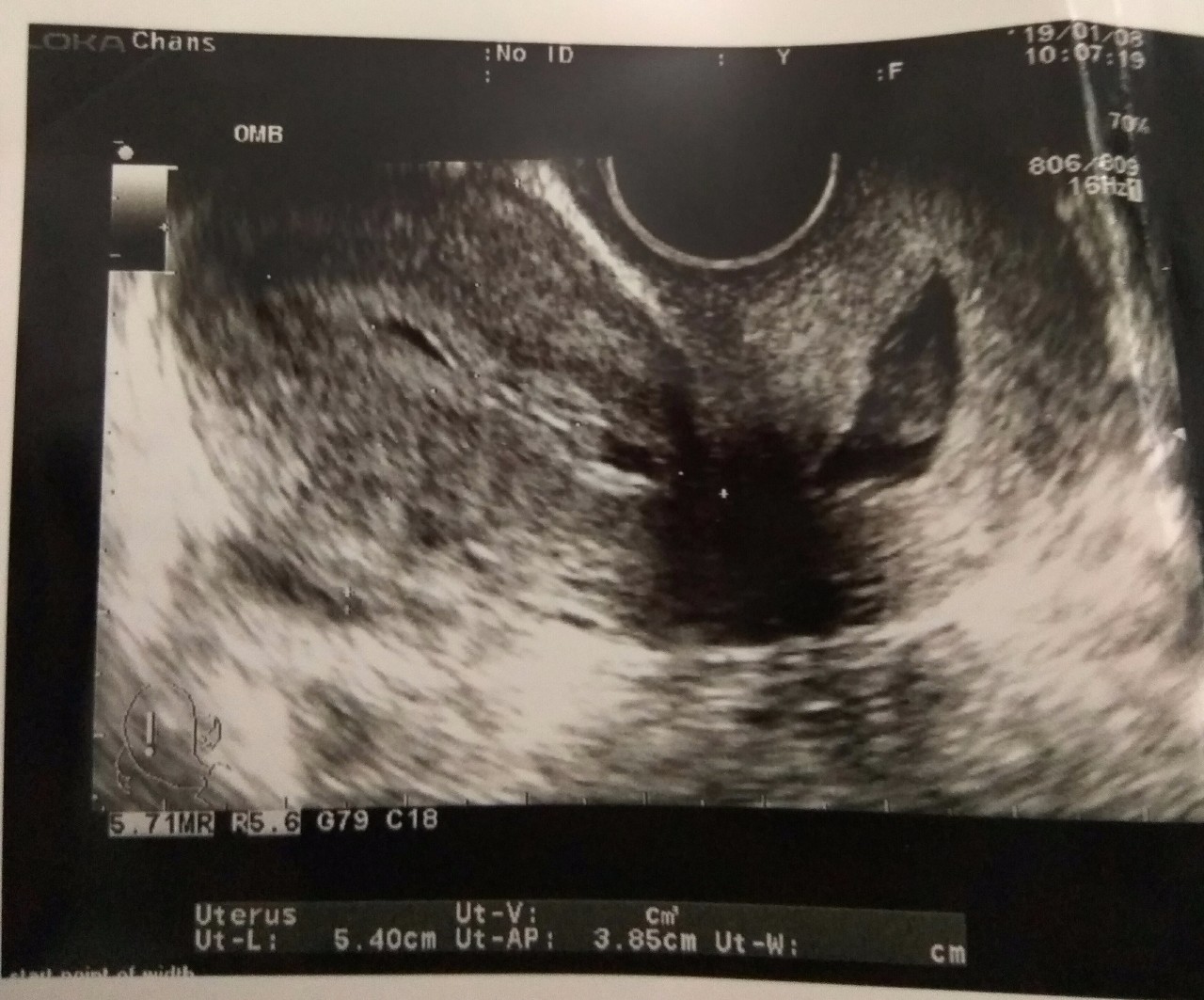 Фото на ранних сроках беременности фото 2 недели