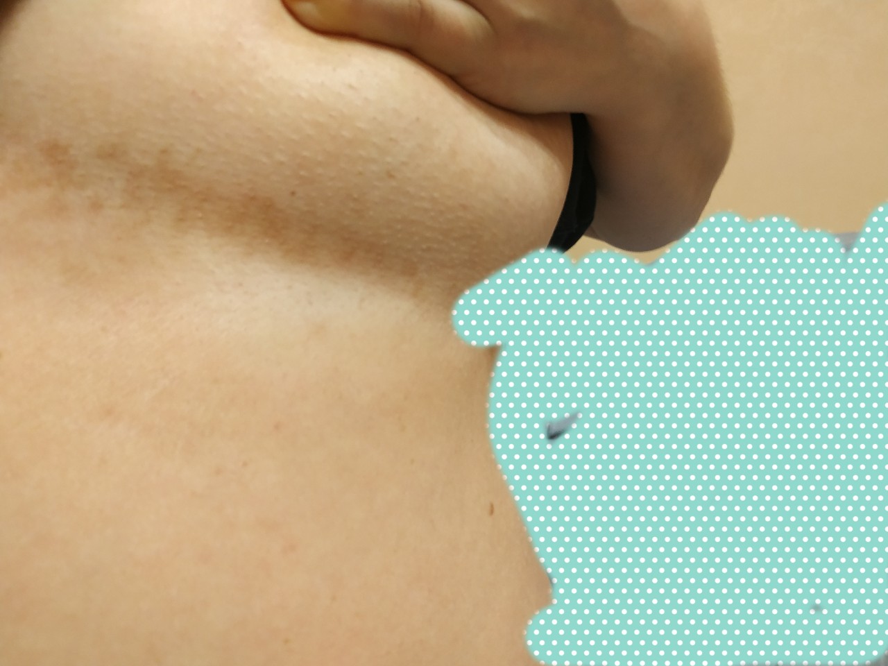 пигментация на грудях у женщин фото 85