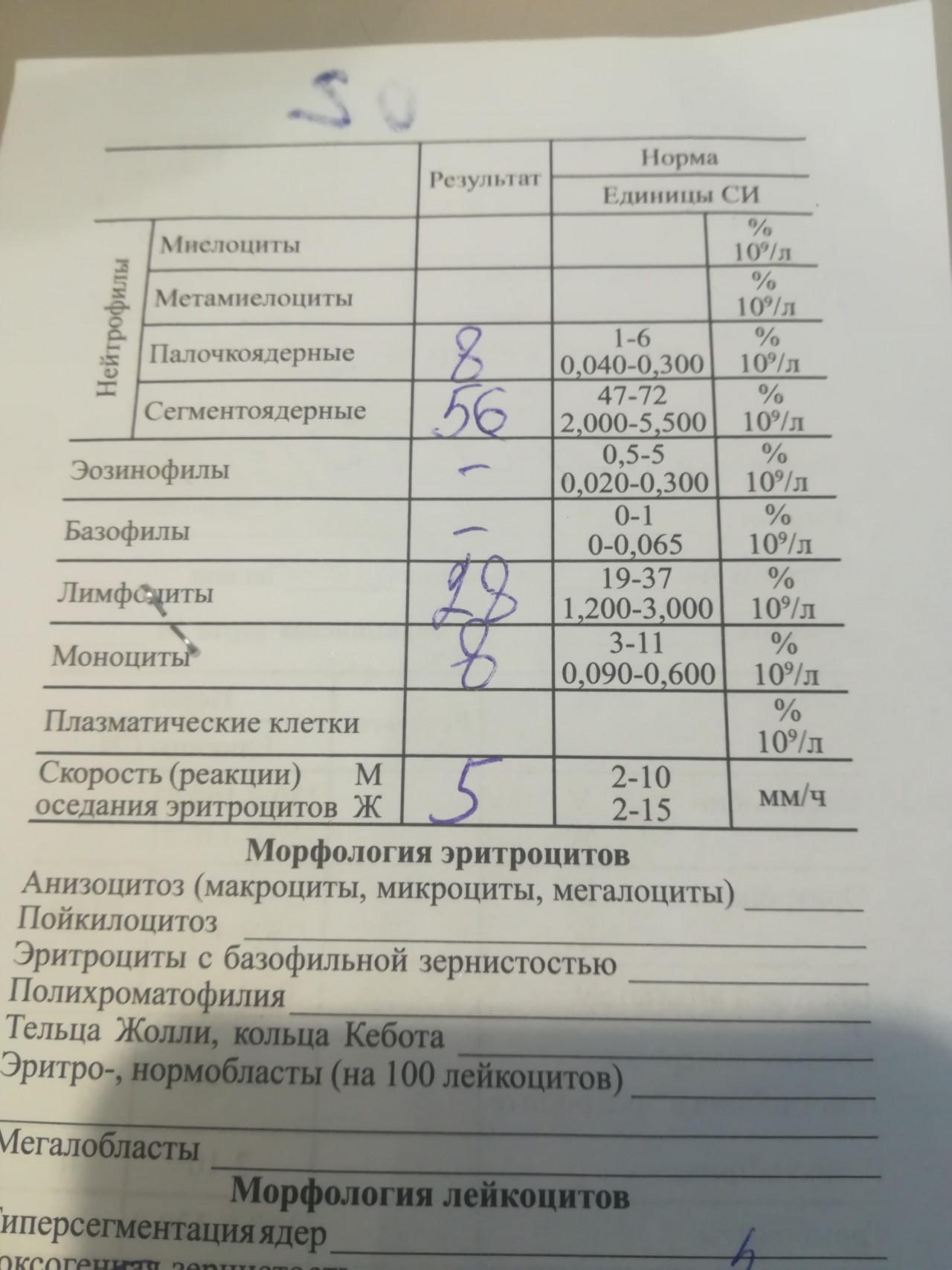 Повышенные палочкоядерные. Общий анализ крови палочкоядерные. Полихроматофилы в общем анализе крови. Пойкилоцитоз в общем анализе крови что это такое.