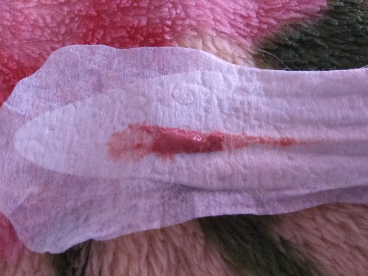 кровяные выделения во время оргазма фото 53