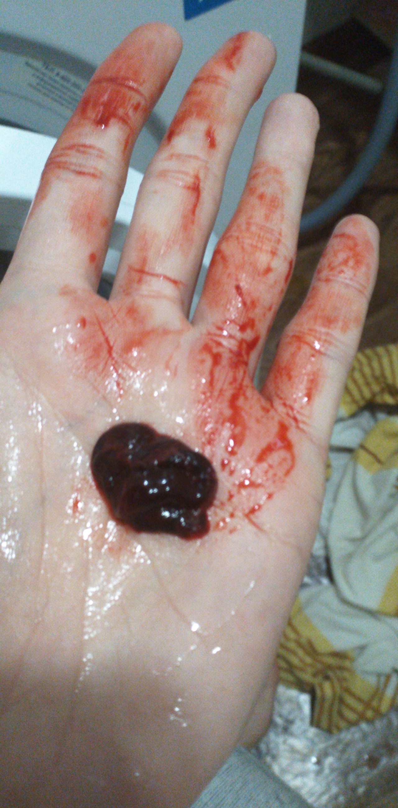 кровь из члена один сгусток фото 107