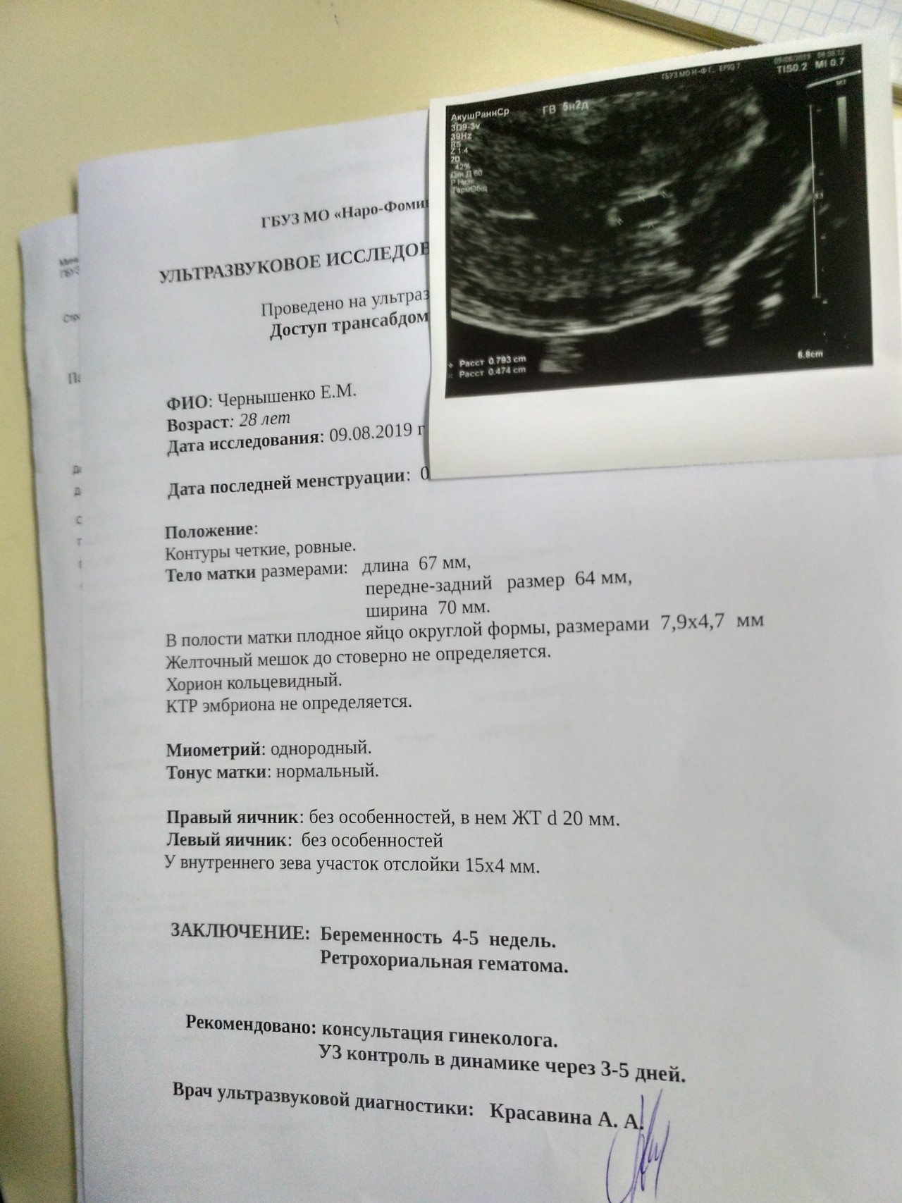 Узи видное отзывы. УЗИ 6 недель беременности желточный мешок. Желточный мешок на УЗИ 4 недели. Желточный мешок при беременности 5 недель.