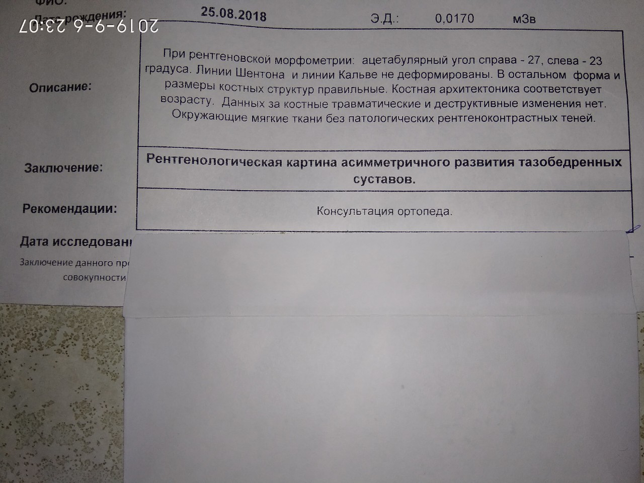 Протокол узи тазобедренного сустава у взрослых образец