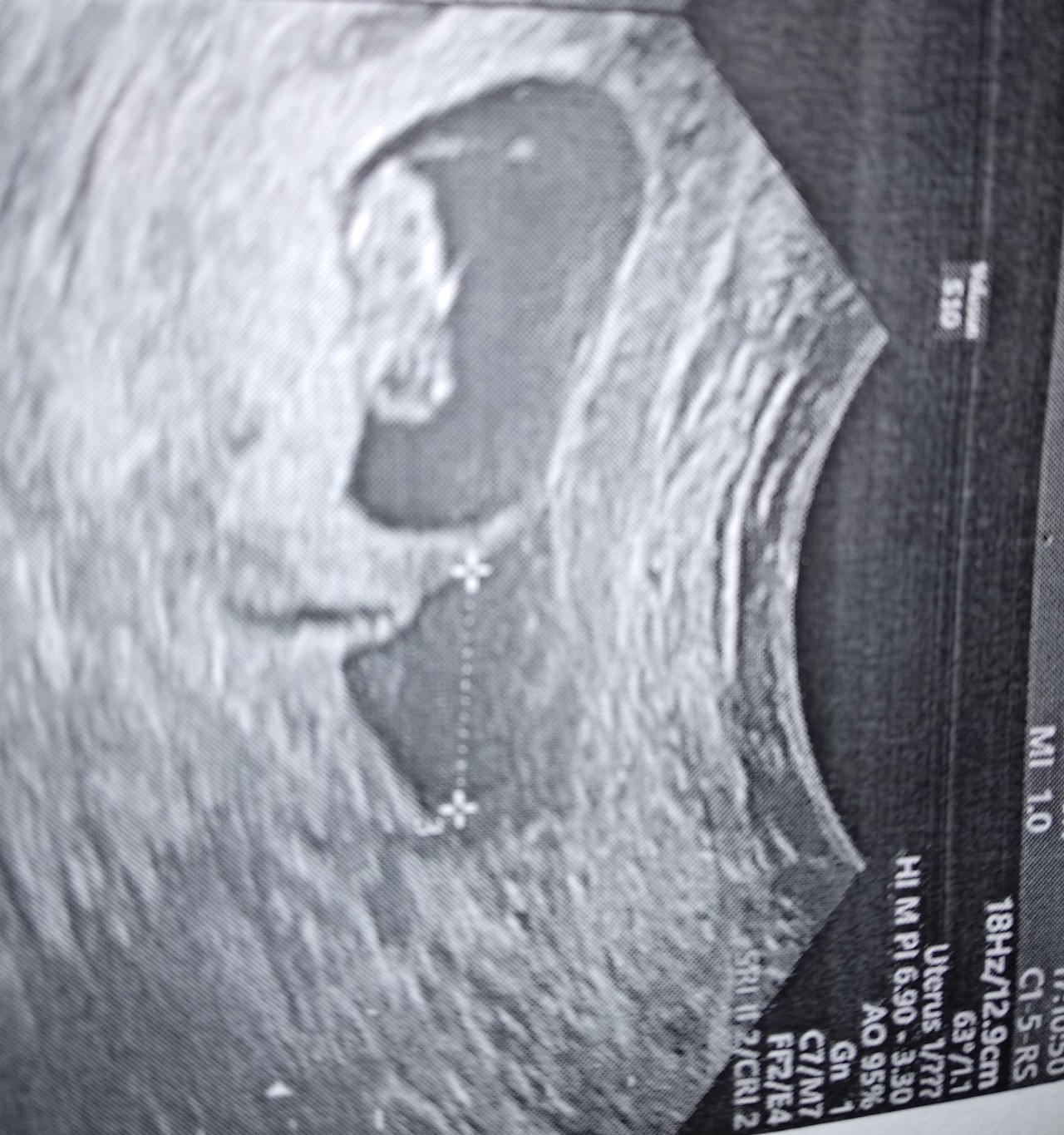 попадает ли сперма в матку при беременности фото 38
