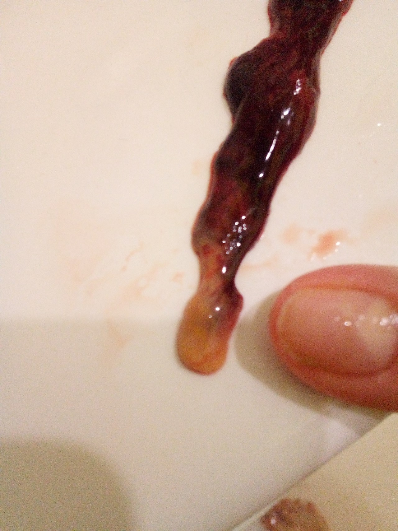 сгустки крови в сперме мужчин фото 67