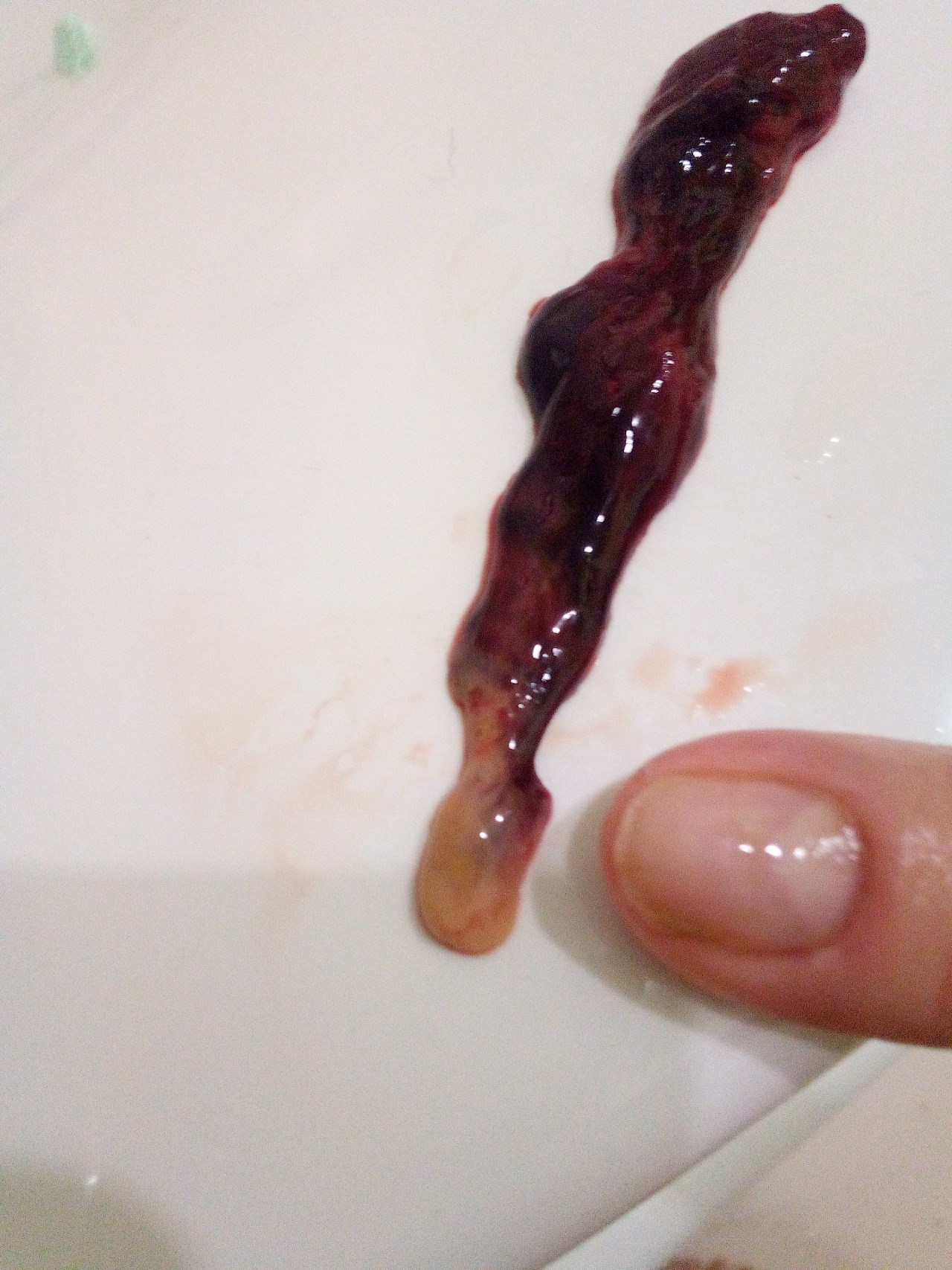 кровяные сгустки в сперме у мужчин фото 64