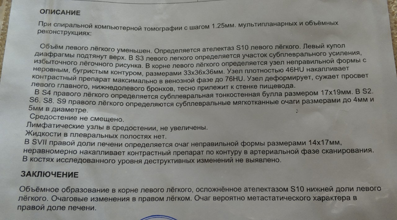 Кт расшифровка. Кт грудной клетки с контрастом расшифровка. Описание кт легких с контрастом. Расшифровка кт грудной клетки. Кт грудной клетки описание.