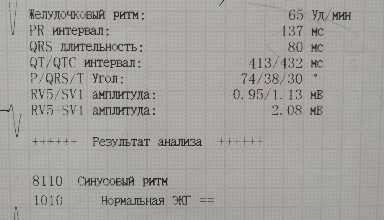 Малый прирост r. Малый прирост r v1-v3 что это такое. Малый прирост з r v1-v4.