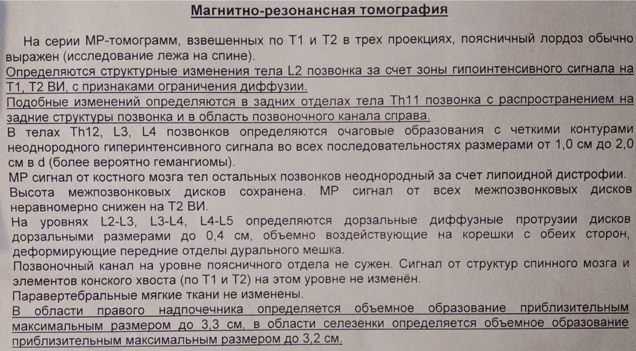 Мрт поясничного отдела позвоночника как подготовиться