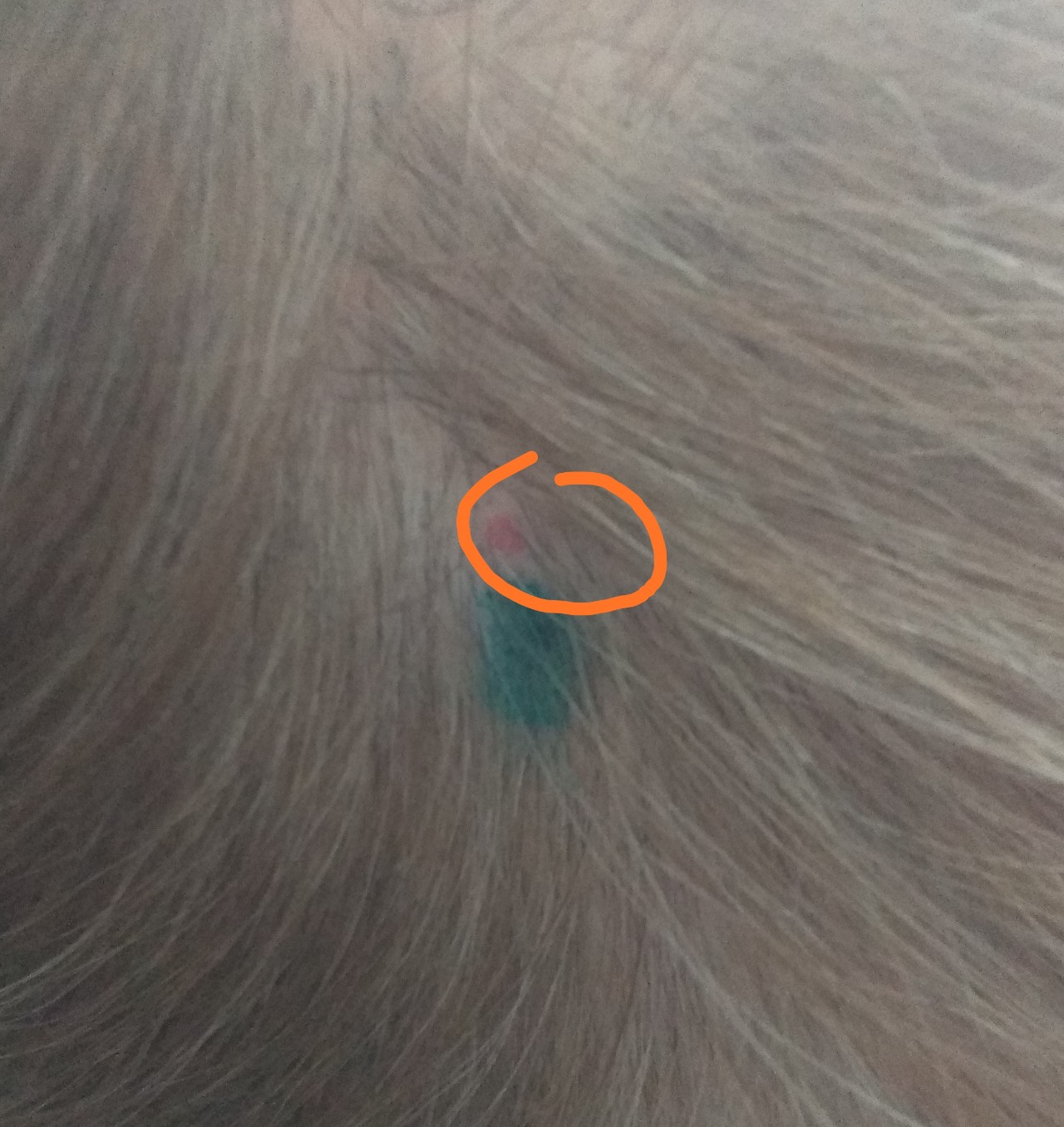 Невус волосистой части головы