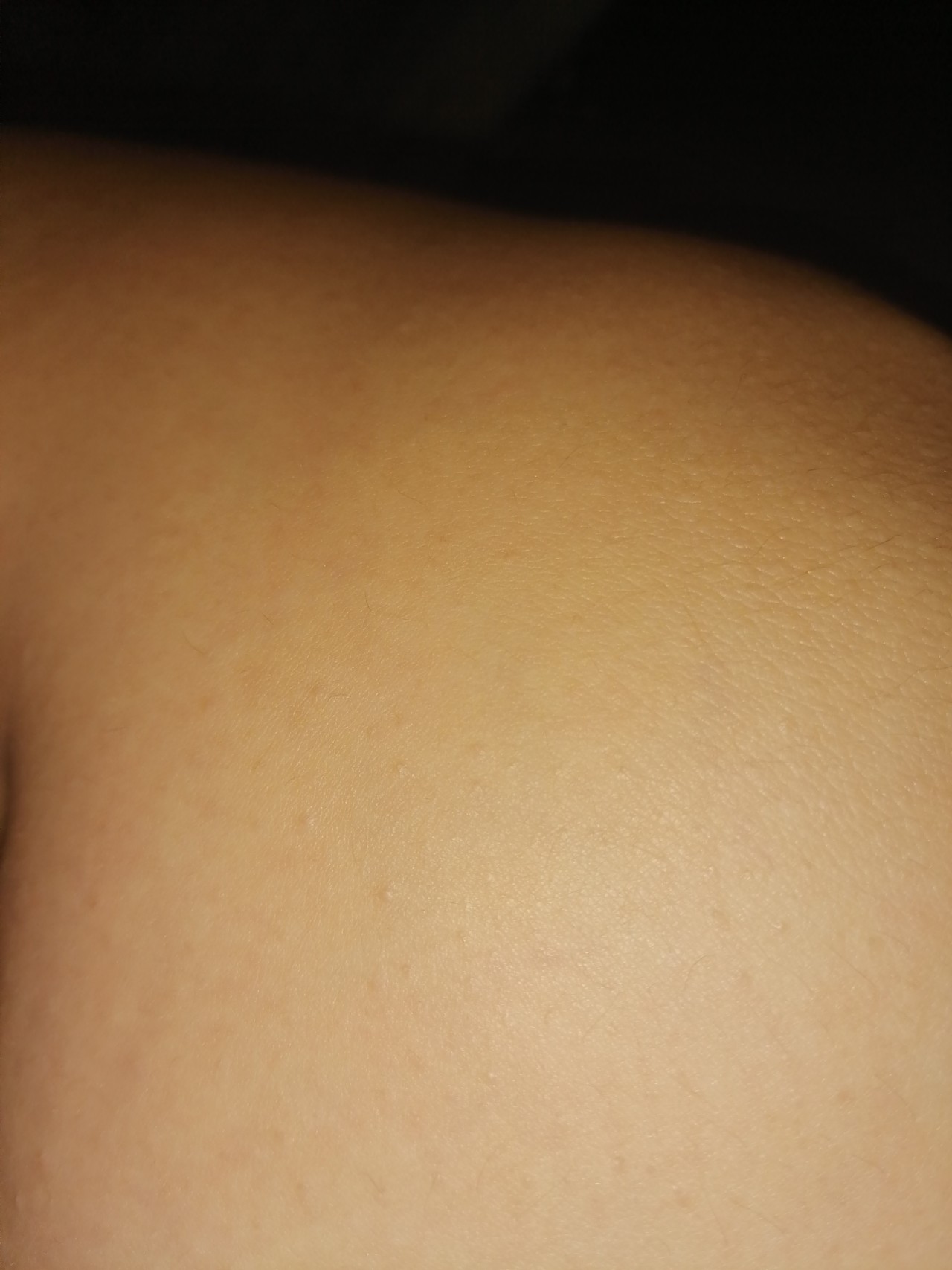 гусиная кожа на груди у женщин фото 30