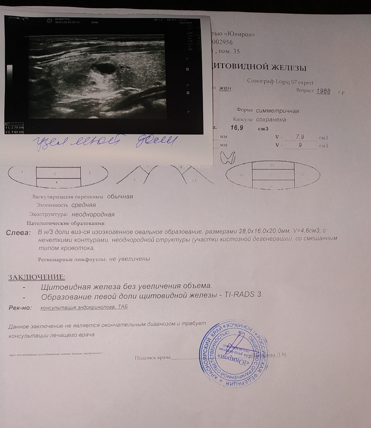 Ti rads обеих долей