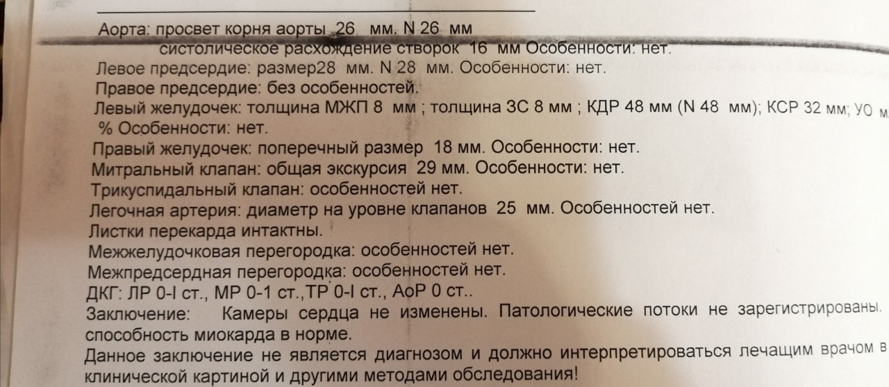 Недавно сделал экг своего сердца не поверил но взглянул на диаграмму и нашел там твое