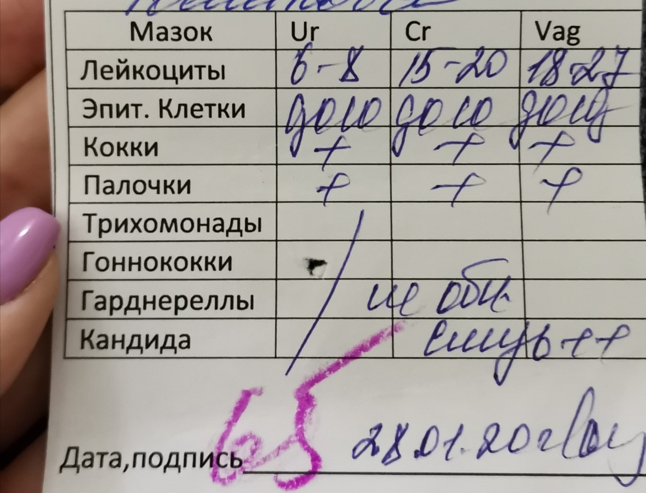 Мазок на герпес. Соскоб с языка на грибы. Анализ соскоб с языка. Соскоб с языка на кандиды.