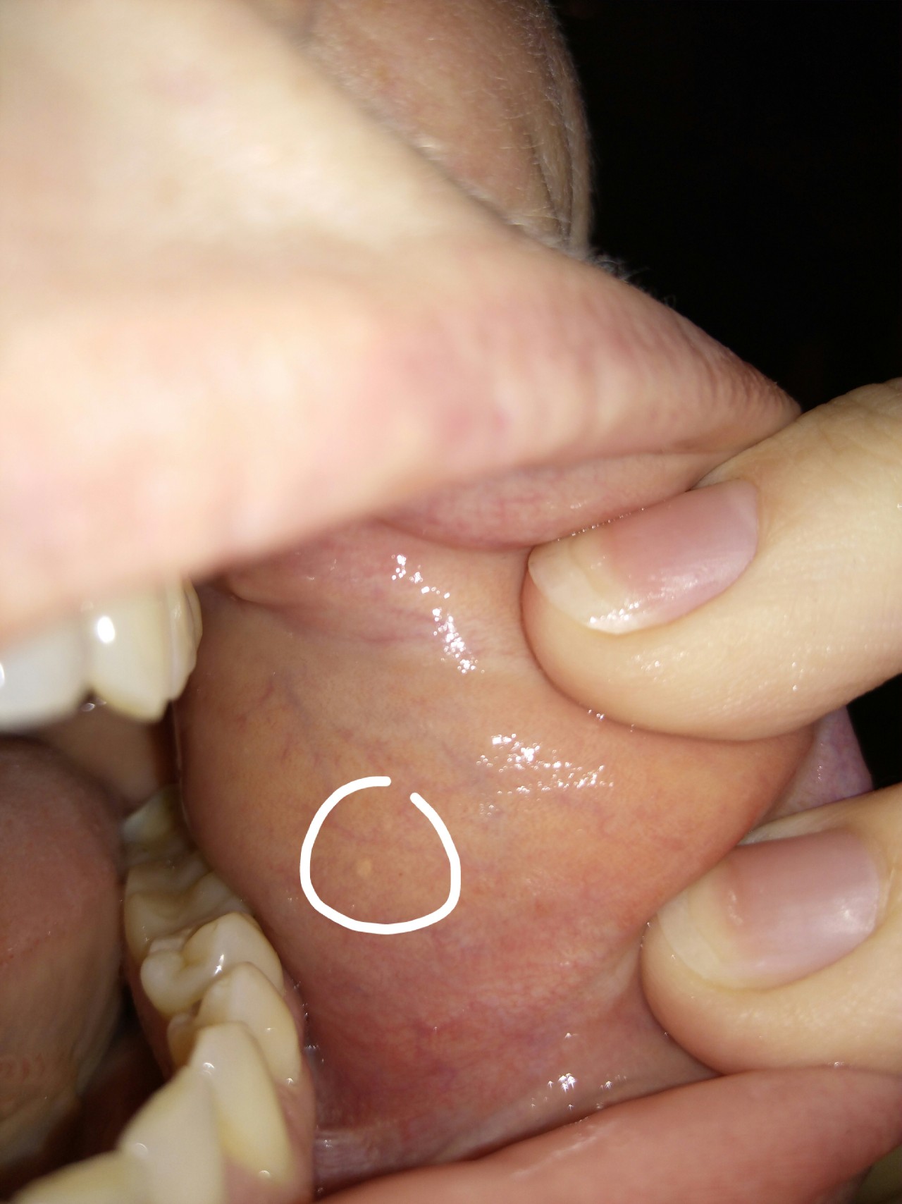 сперма на слизистой рта фото 115