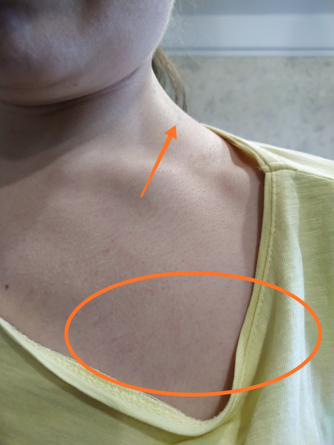 лимфатические узлы на груди у женщин фото 117