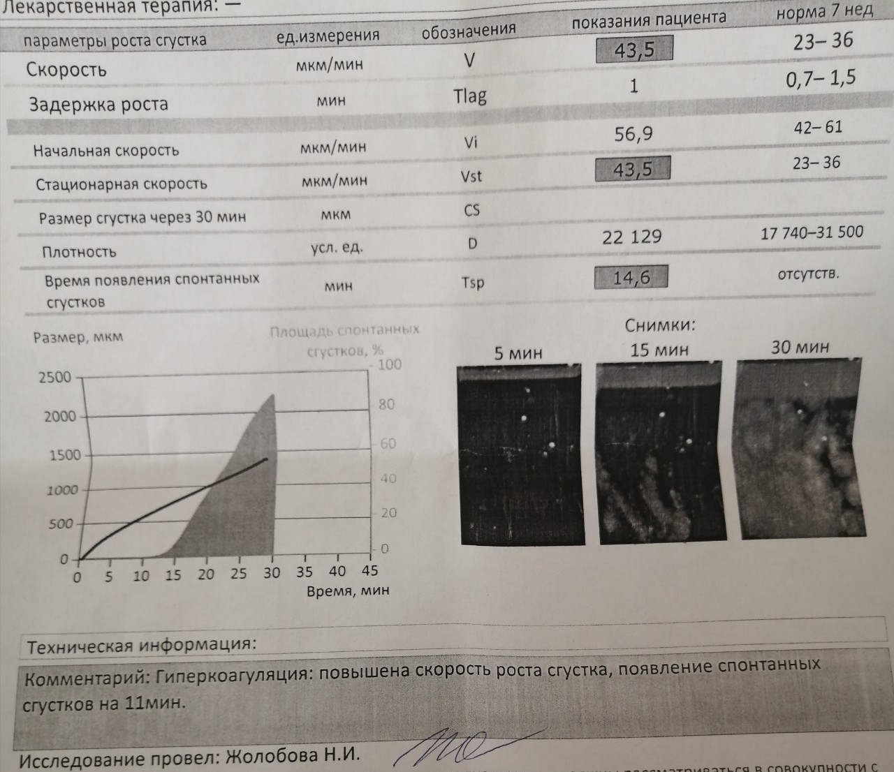 Тромбодинамика инвитро. Исследование тромбодинамики. Тромбодинамика анализ. Нормы тромбодинамики при беременности. Исследование тромбодинамики при беременности нормы.