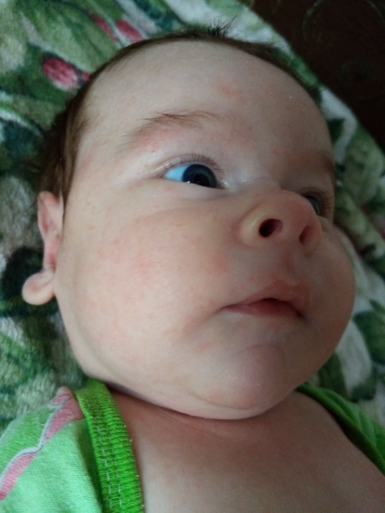 Щетина у младенцев фото