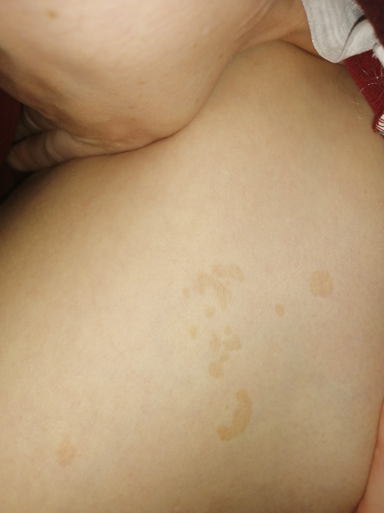 светло коричневые пятна на груди у женщин фото 34