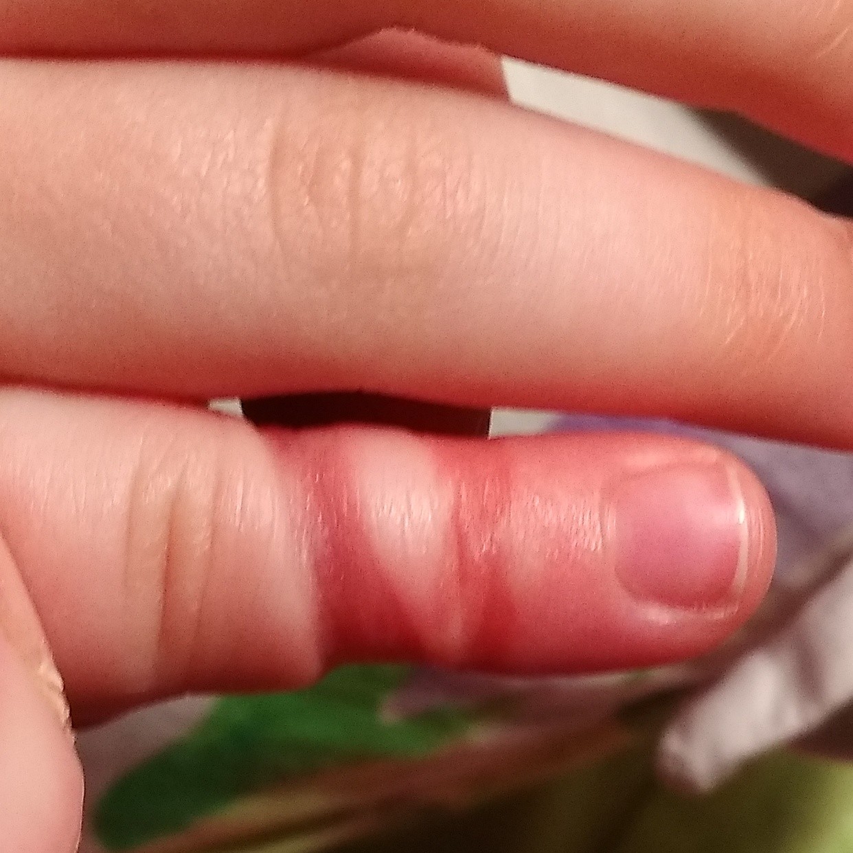 Волос на пальце у младенца