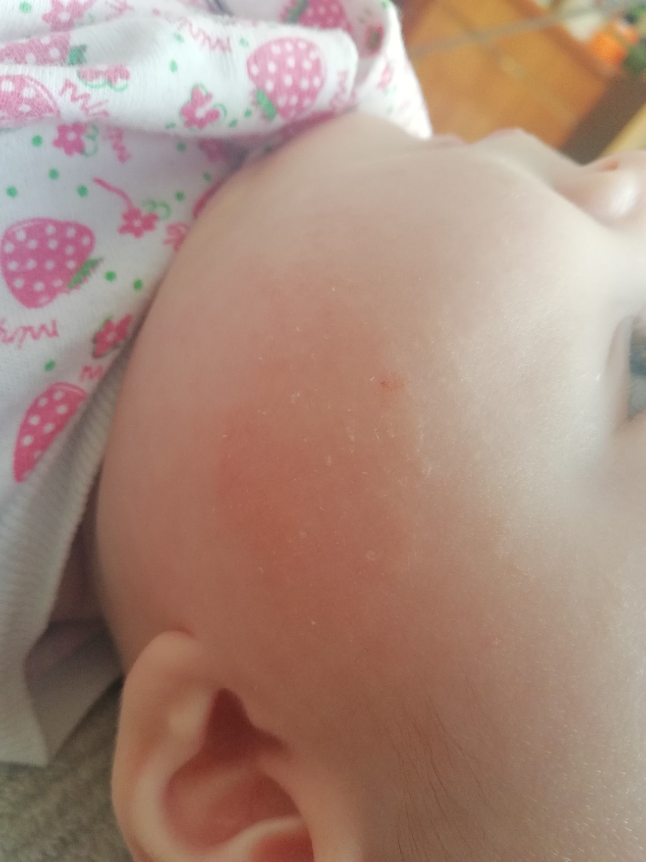Шершавое пятно на щеке у ребенка