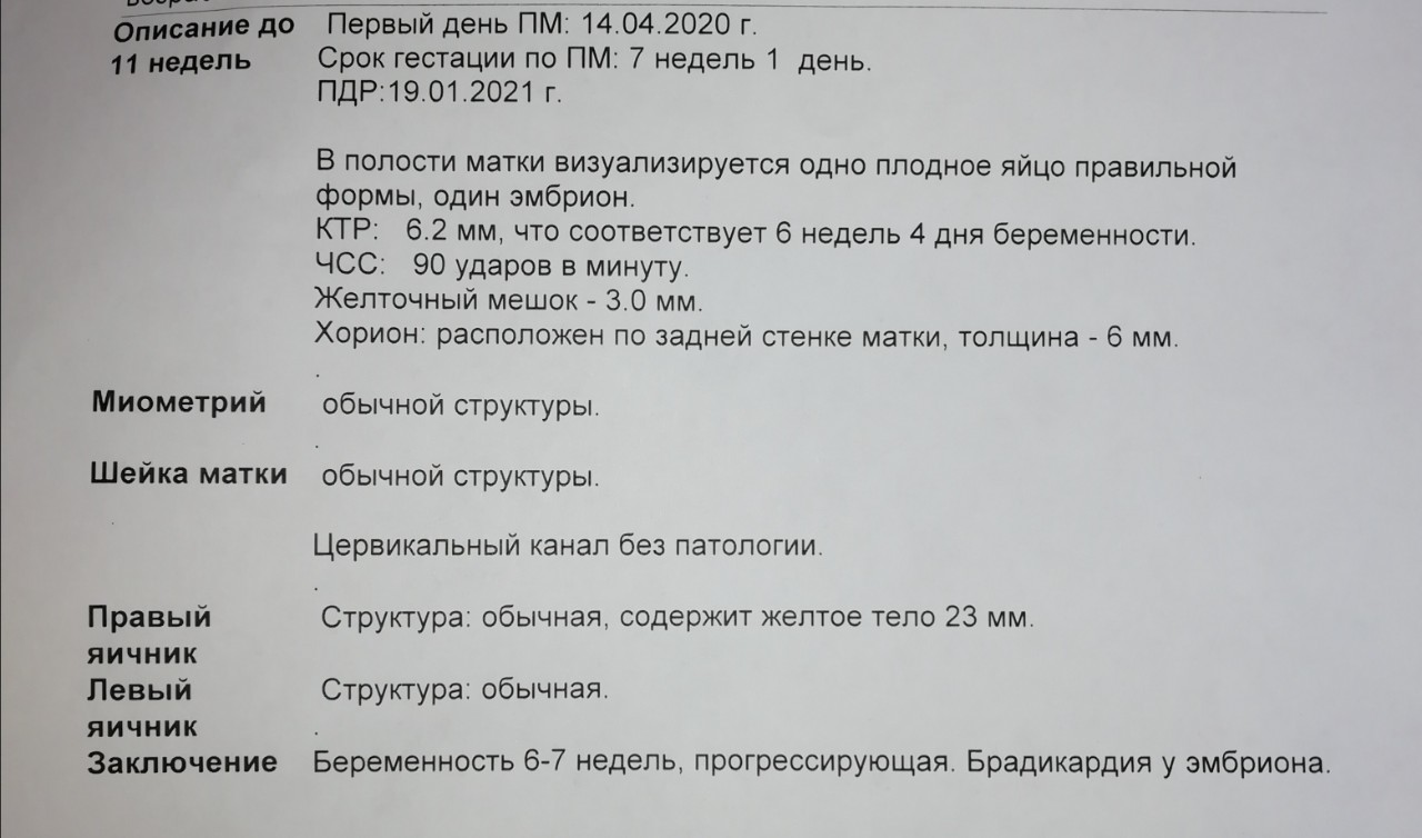 Сердцебиение на какой неделе беременности