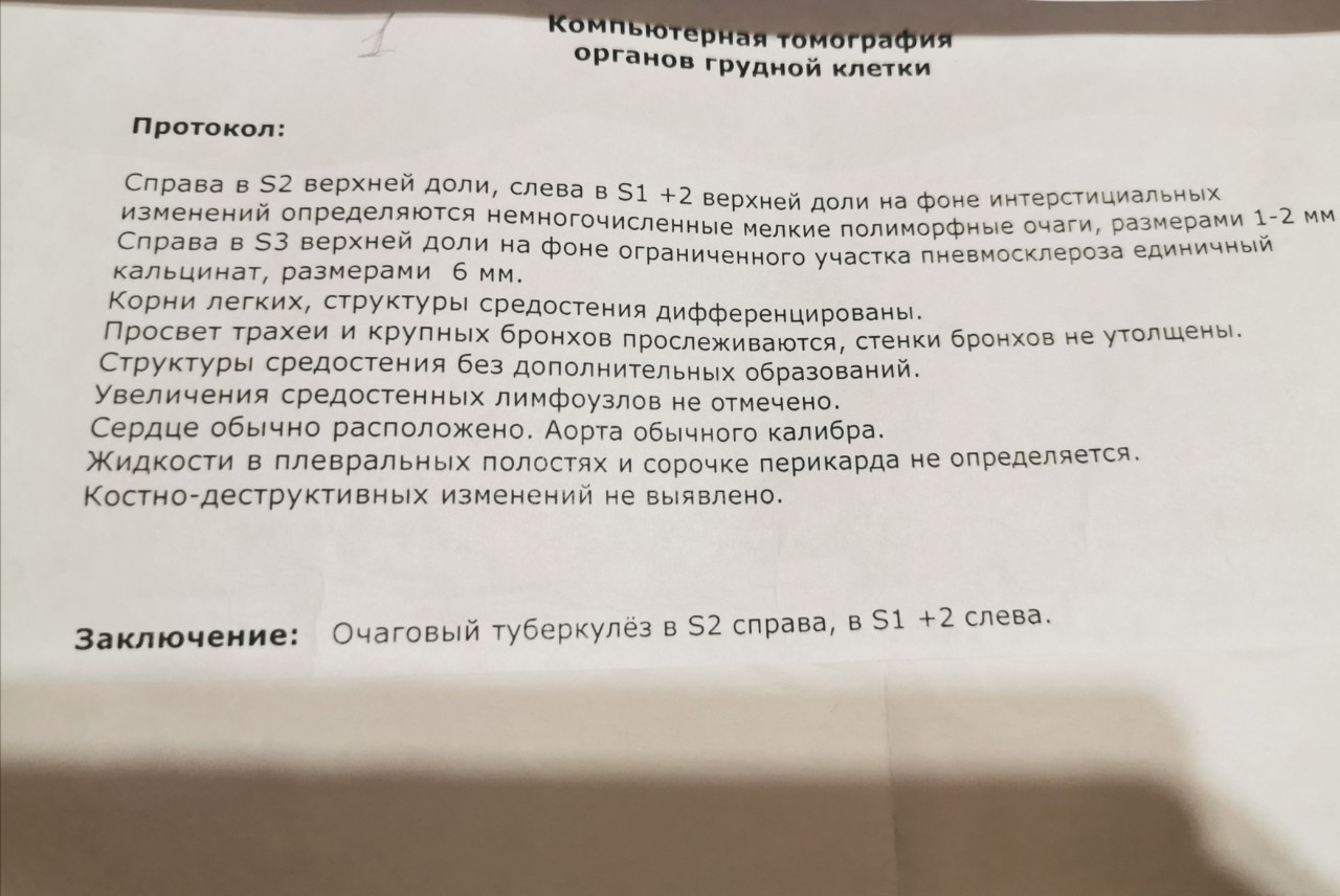 Изменение обнаружено. Заключение кт при туберкулезе. Кт туберкулеза легких заключение. Изменений не выявлено. Туберкулёз на кт заключение.