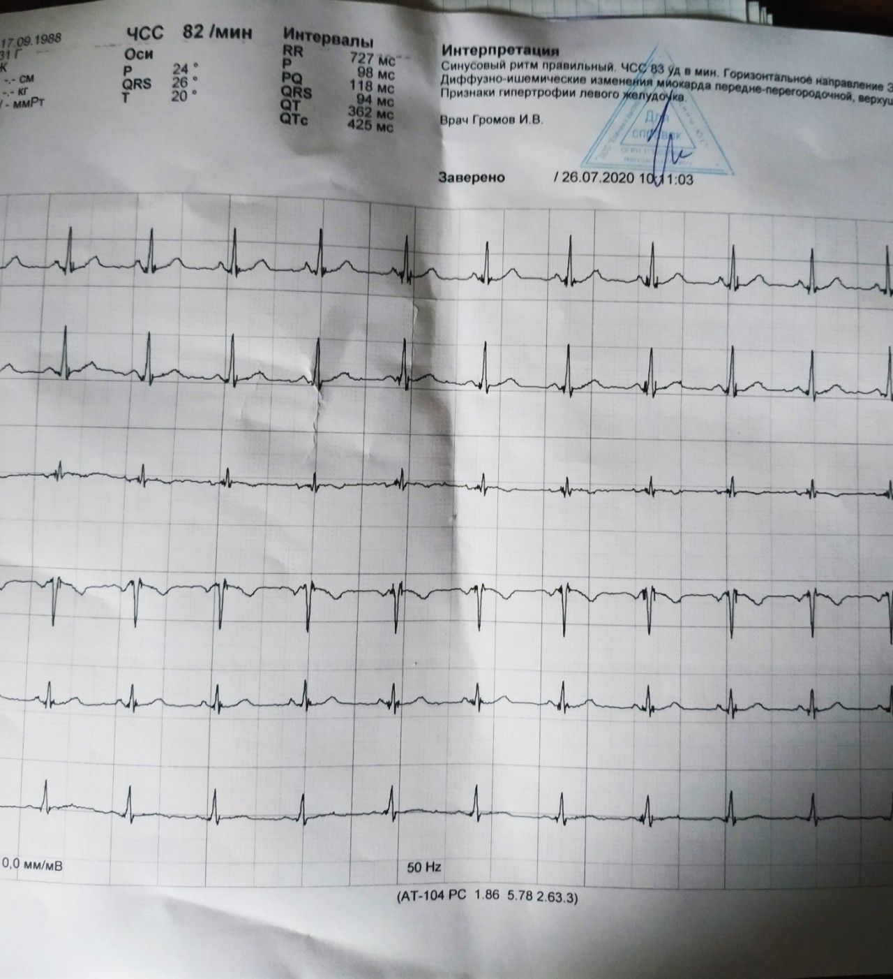 Прочитать экг по фото онлайн