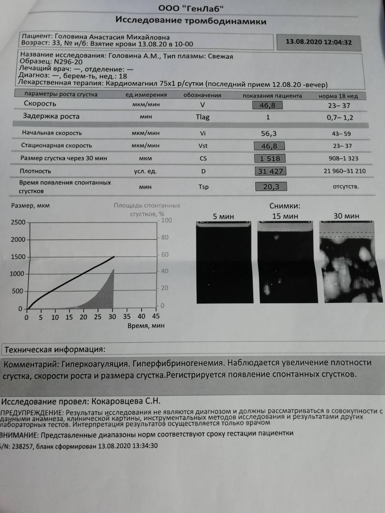 Тромбодинамика инвитро. Тромбодинамика при беременности норма по неделям таблица. Анализ крови на тромбодинамику при беременности. Нормы исследования тромбодинамики. Тромбодинамика анализ.